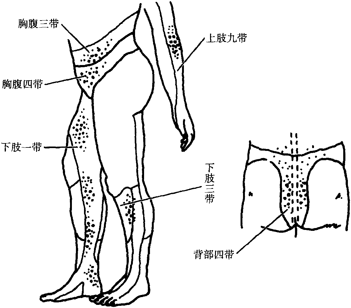三、急性胃腸炎